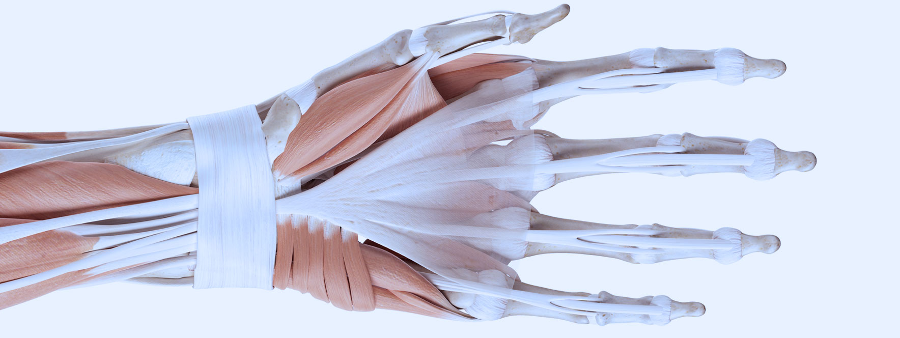 Anatomie des muscles du poignet, tendinite