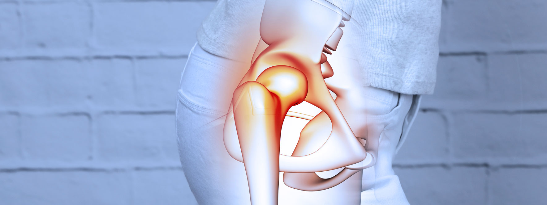 Approcher le ressaut de hanche | Réseau massothérapeutes